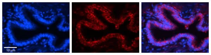 IHC-P analysis of human bronchial epithelial tissue using GTX47427 RPLP0 antibody at 1:100. Left to right:DAPI, RPLP0, Merge. Low pH, heat-induced antigen retrieval method utilizing Sodium Citrate buffer. IHC-P analysis of human bronchial epithelial tissue using GTX47427 RPLP0 antibody at 1:100. Left to right:DAPI, RPLP0, Merge. Low pH, heat-induced antigen retrieval method utilizing Sodium Citrate buffer.
