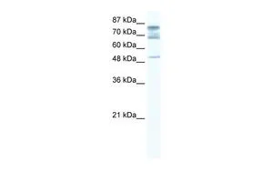 WB analysis of Jurkat cells using GTX47439 DDX46 antibody at 1.25microg/ml. WB analysis of Jurkat cells using GTX47439 DDX46 antibody at 1.25microg/ml.