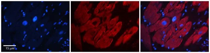 IHC-P analysis of human heart tissue using GTX47440 G3BP1 antibody at 1:100. Left to right : DAPI, G3BP1, Merge. Heat-induced antigen retrieval method utilizing Sodium Citrate buffer. IHC-P analysis of human heart tissue using GTX47440 G3BP1 antibody at 1:100. Left to right : DAPI, G3BP1, Merge. Heat-induced antigen retrieval method utilizing Sodium Citrate buffer.