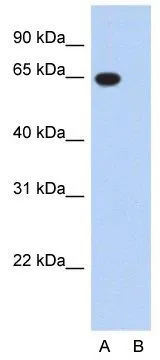 WB analysis of HepG2 cells using GTX47441 G3BP antibody at 2.5microg/ml. Lane A:Primary Antibody Lane B: Primary Antibody + Blocking Peptide.