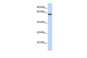 WB analysis of 293T cells using GTX47444 KCNV1 antibody at 0.2-1microg/ml. WB analysis of 293T cells using GTX47444 KCNV1 antibody at 0.2-1microg/ml.