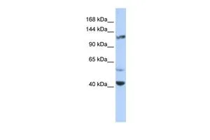 WB analysis of HeLa cells using GTX47445 KCNH3 antibody at 0.2-1microg/ml. WB analysis of HeLa cells using GTX47445 KCNH3 antibody at 0.2-1microg/ml.