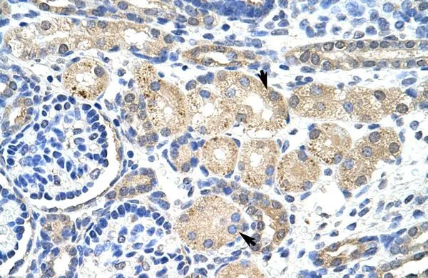 IHC-P analysis of human kidney tissue using GTX47447 KCNAB2 antibody at 4.0-8.0microg/ml. IHC-P analysis of human kidney tissue using GTX47447 KCNAB2 antibody at 4.0-8.0microg/ml.