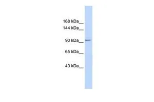 WB analysis of human fetal muscle tissue using GTX47452 KCTD19 antibody at 0.2-1microg/ml. WB analysis of human fetal muscle tissue using GTX47452 KCTD19 antibody at 0.2-1microg/ml.