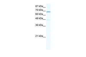 WB analysis of HepG2 cells using GTX47457 Cav beta 2 antibody at 0.2-1microg/ml. WB analysis of HepG2 cells using GTX47457 Cav beta 2 antibody at 0.2-1microg/ml.