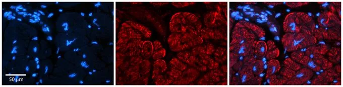 IHC-P analysis of human heart tissue using GTX47464 AKAP7 antibody at 1:600. Left to right:DAPI, AKAP7, Merge. Low pH, heat-induced antigen retrieval method utilizing Sodium Citrate buffer. IHC-P analysis of human heart tissue using GTX47464 AKAP7 antibody at 1:600. Left to right:DAPI, AKAP7, Merge. Low pH, heat-induced antigen retrieval method utilizing Sodium Citrate buffer.