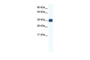 WB analysis of human fetal muscle tissue using GTX47465 CX36 antibody at 1.25microg/ml. WB analysis of human fetal muscle tissue using GTX47465 CX36 antibody at 1.25microg/ml.