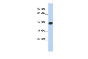 WB analysis of Jurkat cells using GTX47483 GJD2 antibody at 0.2-1microg/ml.