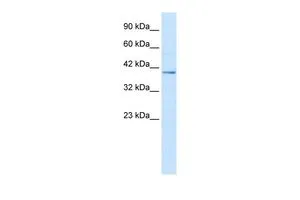 WB analysis of HepG2 cells using GTX47488 NUCB2 antibody at 2.5microg/ml. WB analysis of HepG2 cells using GTX47488 NUCB2 antibody at 2.5microg/ml.