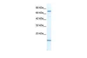 WB analysis of Jurkat cells using GTX47491 PGBD3 antibody at 2.5microg/ml. WB analysis of Jurkat cells using GTX47491 PGBD3 antibody at 2.5microg/ml.