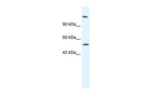 WB analysis of Jurkat cells using GTX47497 HELB antibody at 2.5microg/ml. WB analysis of Jurkat cells using GTX47497 HELB antibody at 2.5microg/ml.