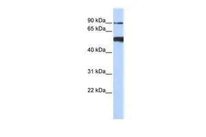 WB analysis of 293T cells using GTX47499 DDX50 antibody at 0.2-1microg/ml. WB analysis of 293T cells using GTX47499 DDX50 antibody at 0.2-1microg/ml.