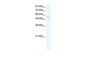 WB analysis of HepG2 cells using GTX47506 DDX19A antibody at 2.5microg/ml. WB analysis of HepG2 cells using GTX47506 DDX19A antibody at 2.5microg/ml.
