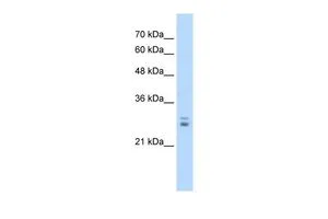 WB analysis of Jurkat cells using GTX47532 KCTD11 antibody at 1.25microg/ml. WB analysis of Jurkat cells using GTX47532 KCTD11 antibody at 1.25microg/ml.