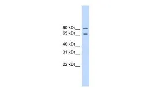WB analysis of human fetal lung tissue using GTX47534 Cav beta 2 antibody at 0.2-1microg/ml. WB analysis of human fetal lung tissue using GTX47534 Cav beta 2 antibody at 0.2-1microg/ml.