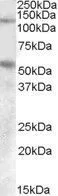 WB analysis of human umbillical cord lysate using GTX47571 Palladin (aa895-907) antibody, Internal. Dilution : 0.1microg/ml Loading : 35microg protein in RIPA buffer WB analysis of human umbillical cord lysate using GTX47571 Palladin (aa895-907) antibody, Internal. Dilution : 0.1microg/ml Loading : 35microg protein in RIPA buffer