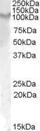 WB analysis of rat kidney lysate using GTX47598 IL17 Receptor alpha antibody, Internal. Dilution : 1microg/ml Loading : 35microg protein in RIPA buffer WB analysis of rat kidney lysate using GTX47598 IL17 Receptor alpha antibody, Internal. Dilution : 1microg/ml Loading : 35microg protein in RIPA buffer