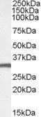 WB analysis of mouse brain lysate using GTX47599 EN2 antibody, C-term. Dilution : 1microg/ml Loading : 35microg protein in RIPA buffer WB analysis of mouse brain lysate using GTX47599 EN2 antibody, C-term. Dilution : 1microg/ml Loading : 35microg protein in RIPA buffer