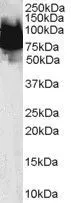 WB analysis of human duodenum lysate using GTX47604 KLF4 antibody, N-term. Dilution : 0.1microg/ml Loading : 35microg protein in RIPA buffer WB analysis of human duodenum lysate using GTX47604 KLF4 antibody, N-term. Dilution : 0.1microg/ml Loading : 35microg protein in RIPA buffer