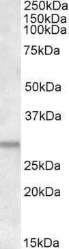 WB analysis of human heart lyssate using GTX47605 ATF5 antibody, C-term. Dilution : 1.5microg/ml Loading : 35microg protein in RIPA buffer WB analysis of human heart lyssate using GTX47605 ATF5 antibody, C-term. Dilution : 1.5microg/ml Loading : 35microg protein in RIPA buffer