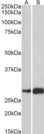 WB analysis of mouse (A) and rat (B) skeletal muscle lysate using GTX47605 ATF5 antibody, C-term. Dilution : 1microg/ml Loading : 35microg protein in RIPA buffer