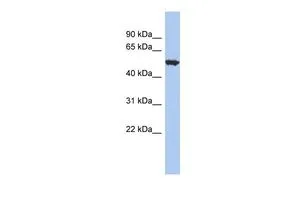 WB analysis of THP-1 cells using GTX47614 ACCN1 antibody at 0.2-1microg/ml. WB analysis of THP-1 cells using GTX47614 ACCN1 antibody at 0.2-1microg/ml.