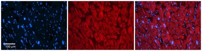 IHC-P analysis of human heart tissue using GTX47629 KCNAB2 antibody at 1:600. Left to right : DAPI, Rabbit IgG, Merge. Low pH, heat-induced antigen retrieval method utilizing Sodium Citrate buffer was performed. IHC-P analysis of human heart tissue using GTX47629 KCNAB2 antibody at 1:600. Left to right : DAPI, Rabbit IgG, Merge. Low pH, heat-induced antigen retrieval method utilizing Sodium Citrate buffer was performed.