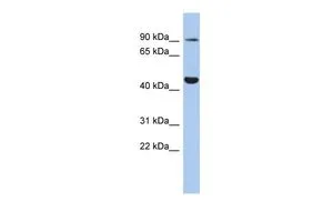WB analysis of OVCAR-3 cells using GTX47633 Kv11.1 antibody at 0.2-1microg/ml.