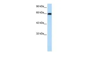 WB analysis of HepG2 cells using GTX47636 VMD2L2 antibody at 1.25microg/ml. WB analysis of HepG2 cells using GTX47636 VMD2L2 antibody at 1.25microg/ml.