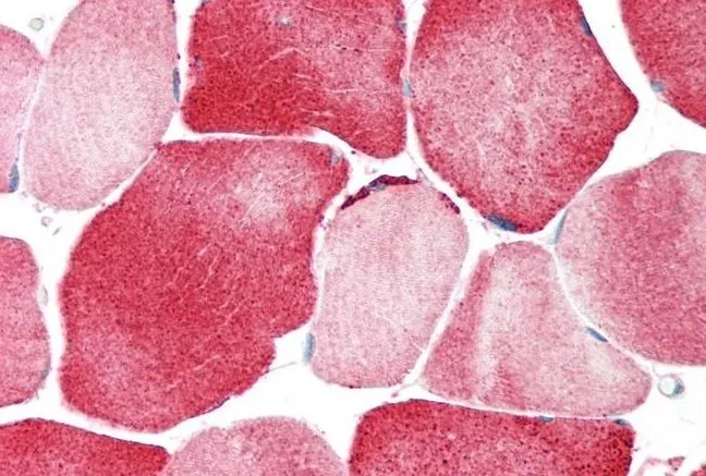 IHC-P analysis of human skeletal muscle tissue using GTX47662 KCNJ12 antibody at 5microg/ml. IHC-P analysis of human skeletal muscle tissue using GTX47662 KCNJ12 antibody at 5microg/ml.