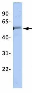 WB analysis of human fetal heart tissue using GTX47662 KCNJ12 antibody at 1microg/ml.