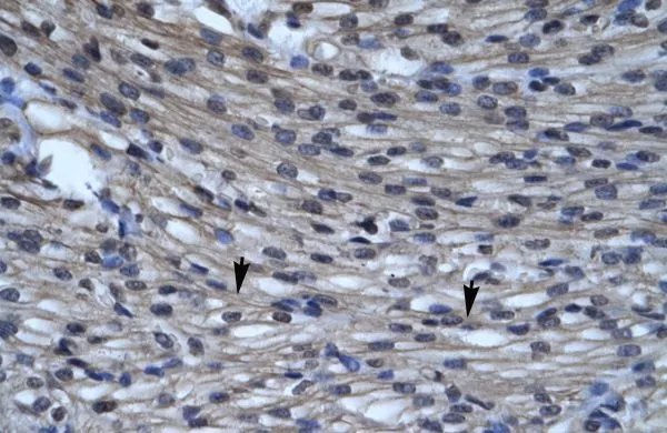 IHC-P analysis of human heart tissue using GTX47672 CLIC5 antibody at 4.0-8.0microg/ml. IHC-P analysis of human heart tissue using GTX47672 CLIC5 antibody at 4.0-8.0microg/ml.