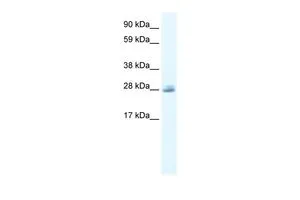 WB analysis of Jurkat cells using GTX47672 CLIC5 antibody at 0.2-1microg/ml.
