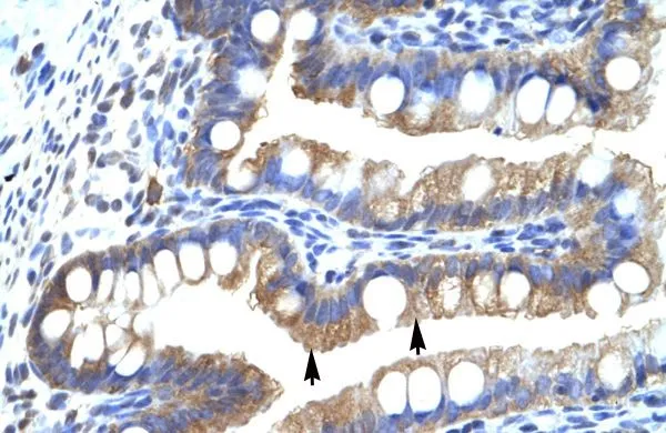 IHC-P analysis of human intestine tissue using GTX47673 CLIC5 antibody at 4.0-8.0microg/ml. IHC-P analysis of human intestine tissue using GTX47673 CLIC5 antibody at 4.0-8.0microg/ml.