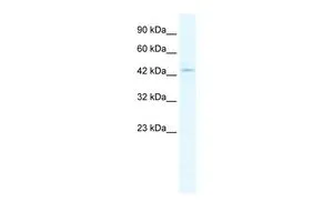 WB analysis of Jurkat cells using GTX47673 CLIC5 antibody at 1.25microg/ml.