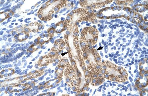IHC-P analysis of human kidney tissue using GTX47683 KCNA10 antibody at 4.0-8.0microg/ml. IHC-P analysis of human kidney tissue using GTX47683 KCNA10 antibody at 4.0-8.0microg/ml.