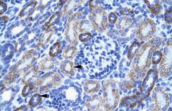 IHC-P analysis of human kidney tissue using GTX47689 ACCN3 antibody at 4.0-8.0microg/ml. IHC-P analysis of human kidney tissue using GTX47689 ACCN3 antibody at 4.0-8.0microg/ml.