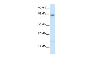 WB analysis of human kidney tissue using GTX47689 ACCN3 antibody at 2.5microg/ml.