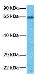 WB analysis of human fetal lung tissue using GTX47689 ACCN3 antibody at 1microg/ml.