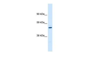 WB analysis of human fetal kidney tissue using GTX47690 KCNAB1 antibody at 0.2-1microg/ml. WB analysis of human fetal kidney tissue using GTX47690 KCNAB1 antibody at 0.2-1microg/ml.