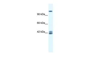 WB analysis of Jurkat cells using GTX47702 NMDAR2C antibody, N-term at 0.2-1microg/ml.