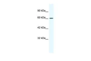 WB analysis of Raji cells using GTX47706 Cav beta 2 antibody at 1.25microg/ml. WB analysis of Raji cells using GTX47706 Cav beta 2 antibody at 1.25microg/ml.