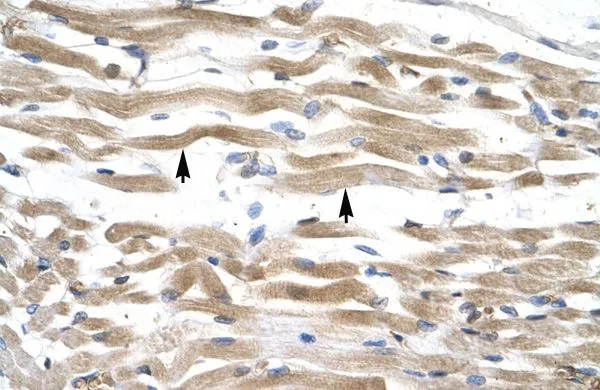 IHC-P analysis of human muscle tissue using GTX47724 KIFC2 antibody at 4.0-8.0microg/ml. IHC-P analysis of human muscle tissue using GTX47724 KIFC2 antibody at 4.0-8.0microg/ml.