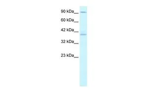 WB analysis of Jurkat cells using GTX47724 KIFC2 antibody at 1.25microg/ml.