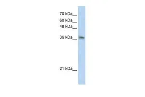 WB analysis of tranfected 293T cells using GTX47737 PHYHIP antibody at 0.2-1microg/ml. WB analysis of tranfected 293T cells using GTX47737 PHYHIP antibody at 0.2-1microg/ml.