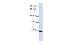 WB analysis of tranfected 293T cells using GTX47764 Claudin 19 antibody at 0.2-1microg/ml. WB analysis of tranfected 293T cells using GTX47764 Claudin 19 antibody at 0.2-1microg/ml.