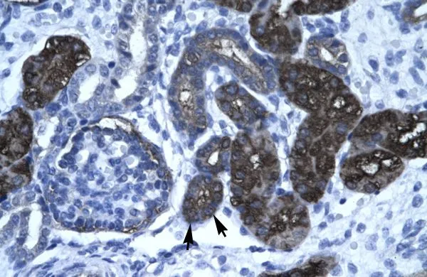 IHC-P analysis of human kidney tissue using GTX47780 Vasculin antibody at 4.0-8.0microg/ml. IHC-P analysis of human kidney tissue using GTX47780 Vasculin antibody at 4.0-8.0microg/ml.
