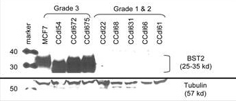 Western blot data of bonemarrow stromal antigen 2 (CD317) on various grade levels of breast cancer cells.