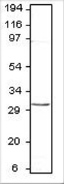 Western blot of Aquaporin 8 using GTX47804 anitbody (1:500) in diluObuffer.