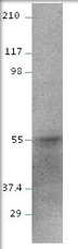 Western blot of E2F2 using GTX47810 antibody. Antibody dilution (1:500) in DiluObuffer